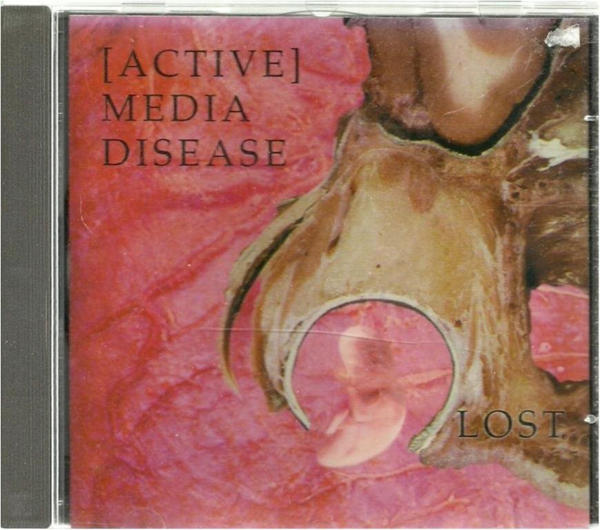ACTIVE MEDIA DISEASE - LOST