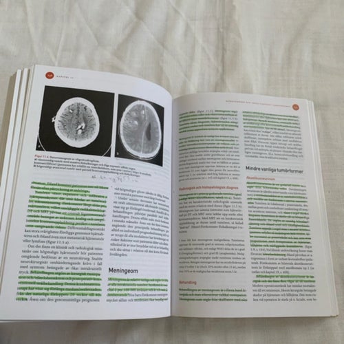 Neurologi av Magnus Aquilonius, 2006