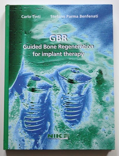GBR: Guided Bone Regeneration for implant therapy