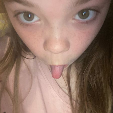 Myaxel