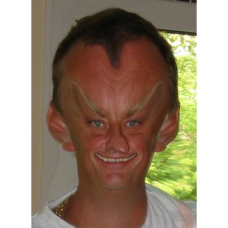 Ulcusmollen