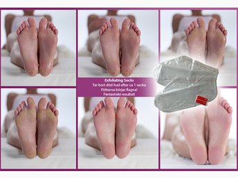 baby foot före och efter baby foot före och efter