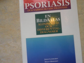 Psoriasis och närbesläktade tillstånd av Johan Landegren och Håkan Mobacken