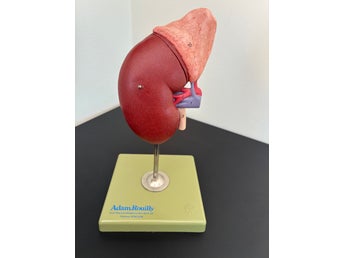 Anatomisk modell: Njure med binjure (SOMSO / Adam, Rouilly)